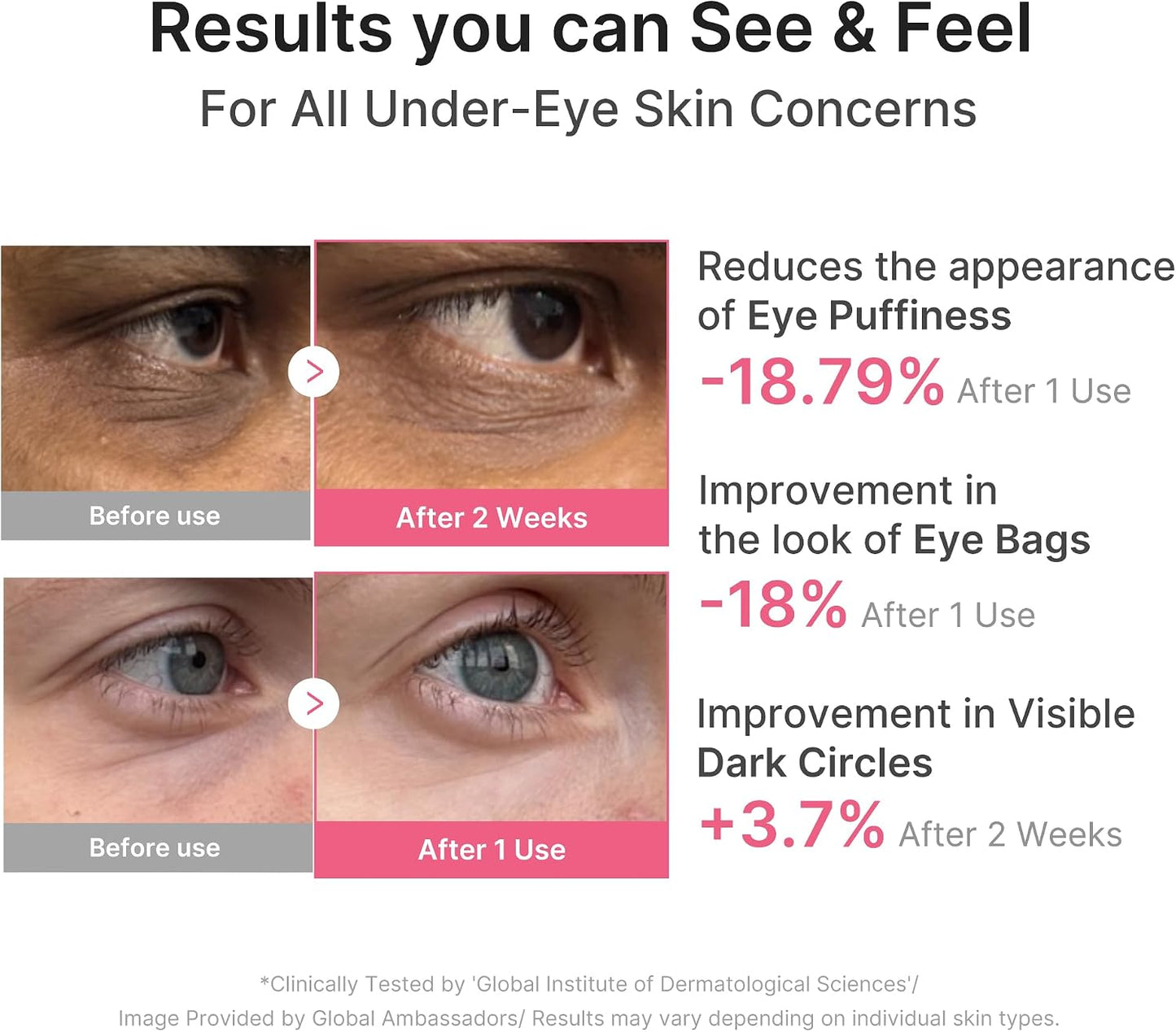 Eye Patch PDRN Caffeine Collagen - Firming Gel Patches, | Age-Defying Care with Retinol & Collagen - Gel Patches for the Appearance of Dark Circles, Undereye Bags, Korean Skincare